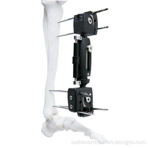 Xcaliber Fixator Ortho Fix Radiolucent Fixator Xcaliber Meta-Diaphyseal Fixator Radiolucent Tibia Fixator